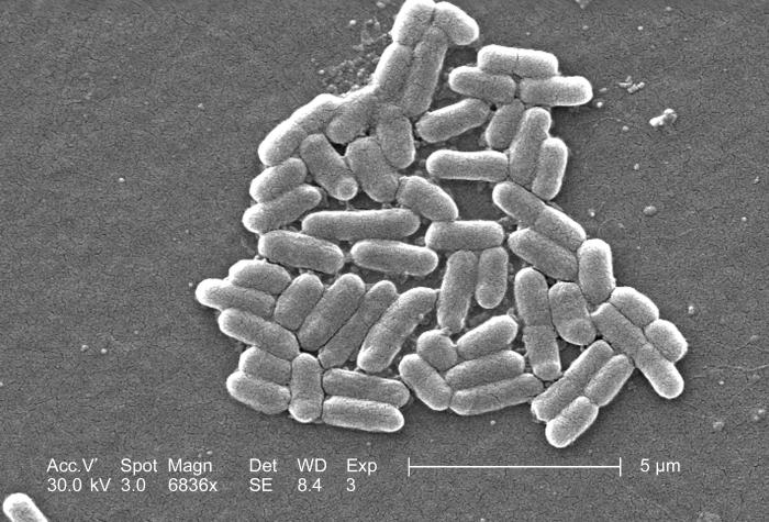 File:E. coli O157-H7.jpg