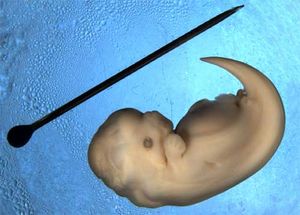 Dolphin embryo.jpg