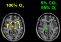 Thumbnail for version as of 19:57, 11 March 2022